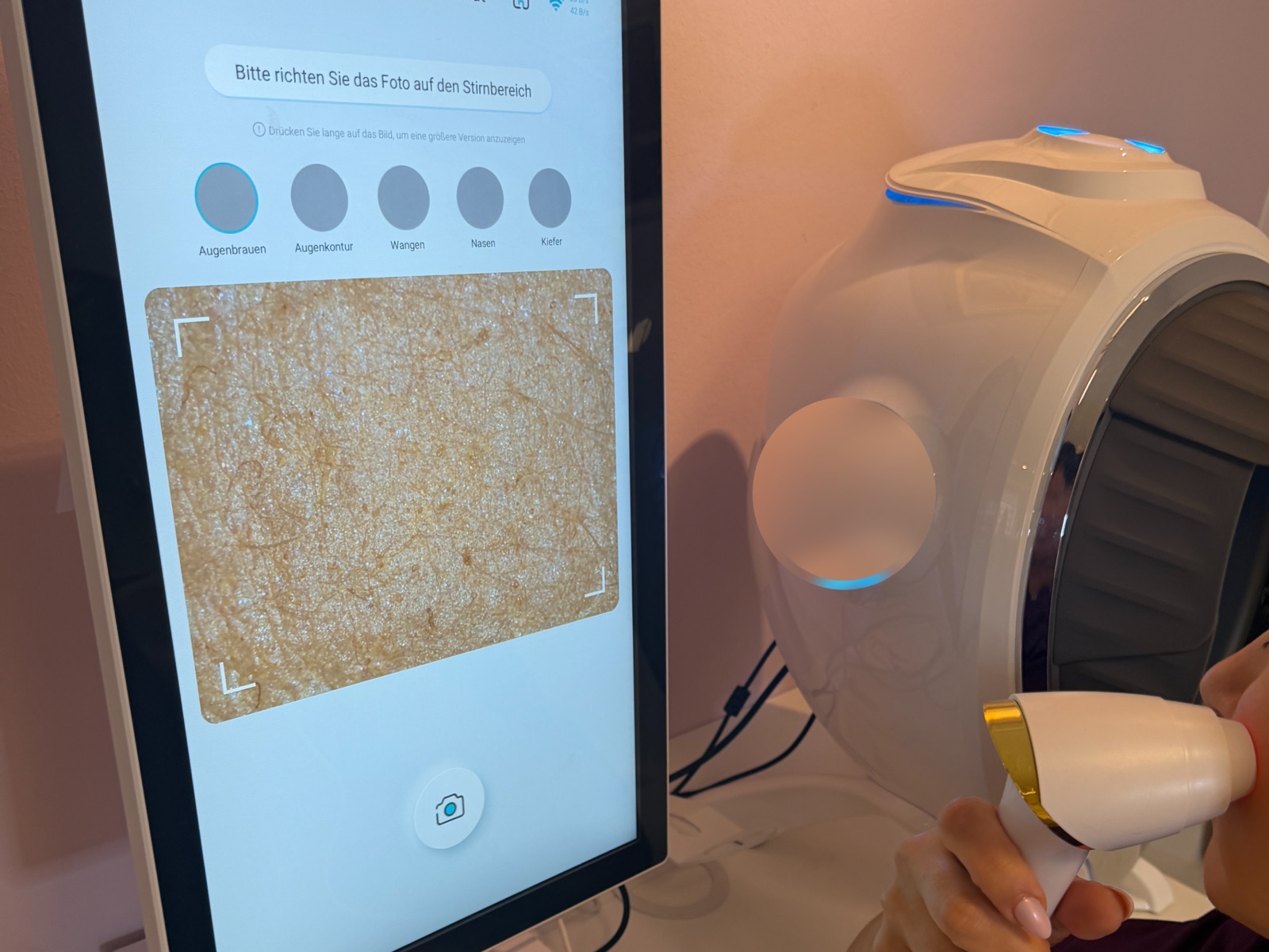 Mikroskopische Hautanalyse mit Handstück, Hautstruktur stark vergrößert